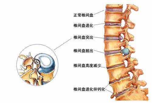 包含擅長：腰間盤突出、腰椎狹窄、頸腰痛等病癥的治療。號販子代掛號，一個電話輕輕松松幫您搞定疑難問題的詞條