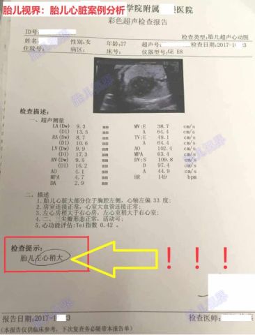 胎儿心脏左右 不对称 一侧偏大 孕妈该何以应对 腾讯网