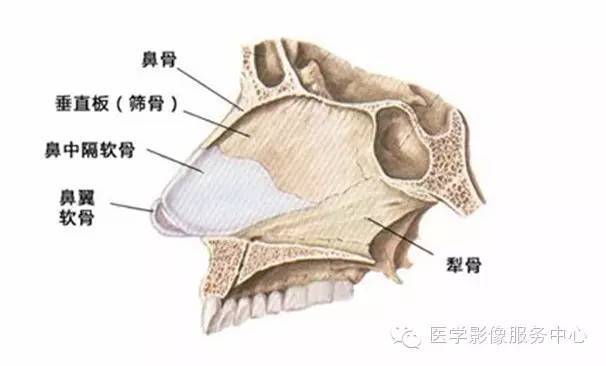 鼻中隔偏曲的影像学表现