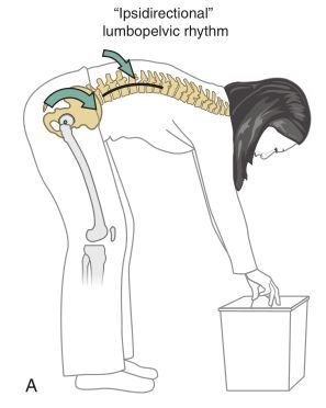 弯腰痛、弯腰受限,问题不在腰椎,要注意这里!