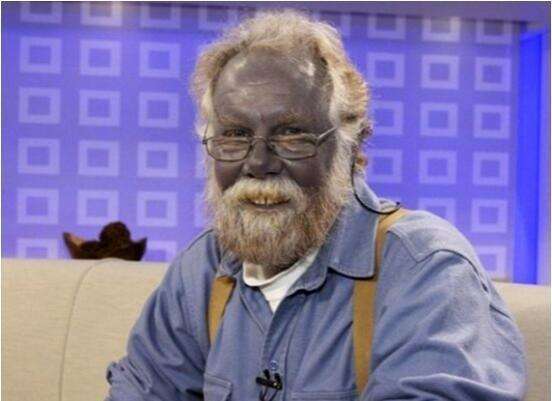 世界上最神奇的蓝种人,生活在6000米的山上,当地人称不祥之物!