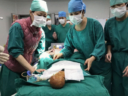 他想活下去!早产宝宝手术中突然抓住医生手指