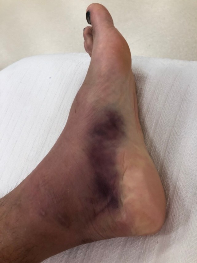 球真妹:权健赢球累惨球迷 竟集体帮前锋撩妹