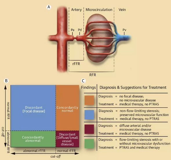 肾血管性高血压目前的诊断与治疗