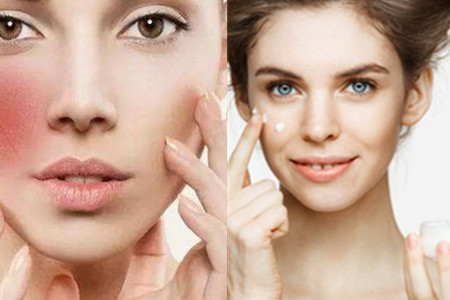 角质层薄用哪类护肤品快速培养健康肤质 腾讯网