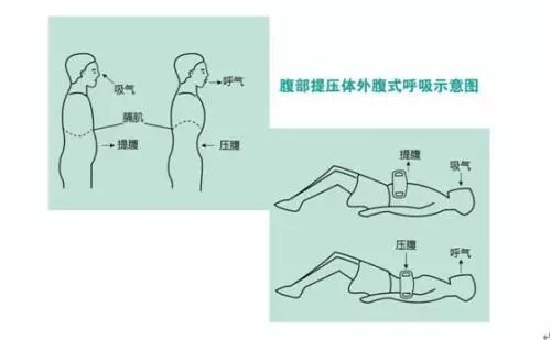 急诊 为避免并发肋骨或胸骨骨折及心脏损伤等问题 学学心肺复苏新思路