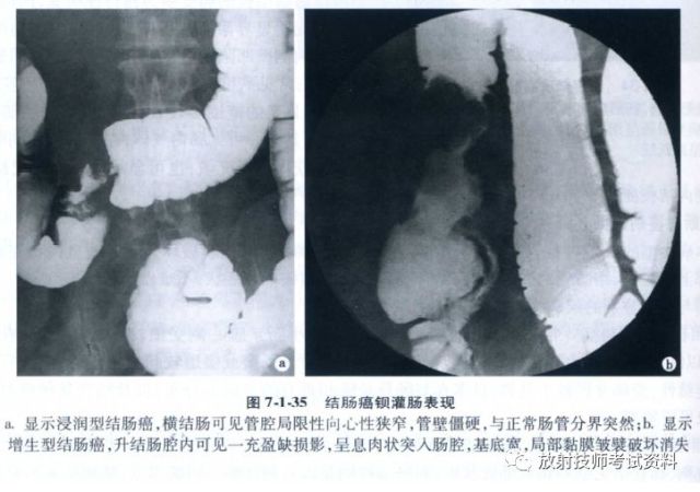 Ct Mr影像诊断基础 消化系统 腾讯网