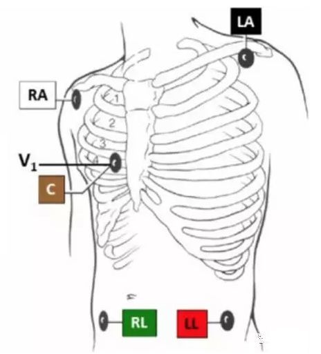 你做的心电图标准吗?来看看这些需要注意的细节_腾讯新闻