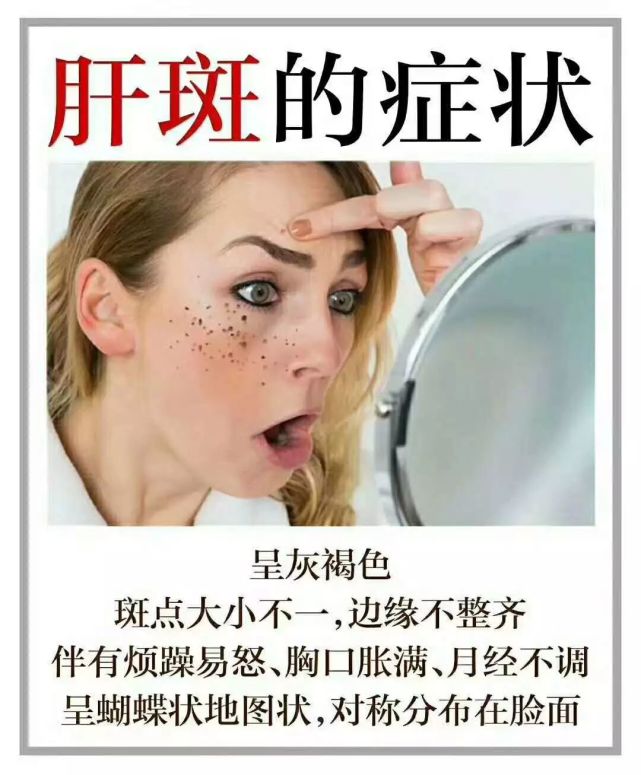 肝斑你不容忽视的身体问题