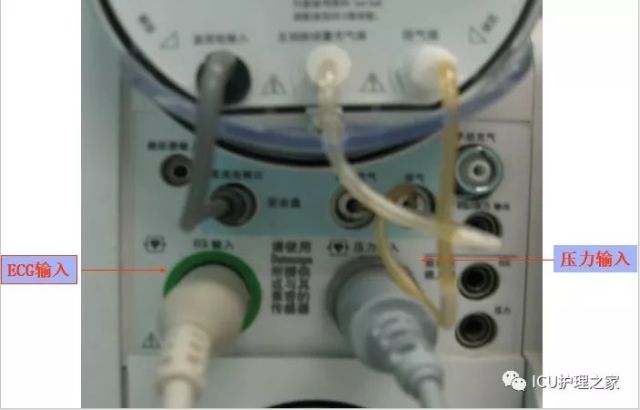 主动脉球囊反搏和监护相关知识讲解!