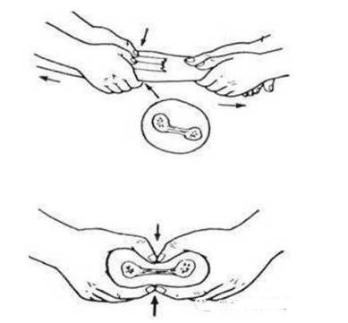 (必看)正骨八种手法介绍