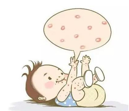 荨麻疹反复,久治不愈怎么办?瘦肉 它,疏风解表,止痒除湿!