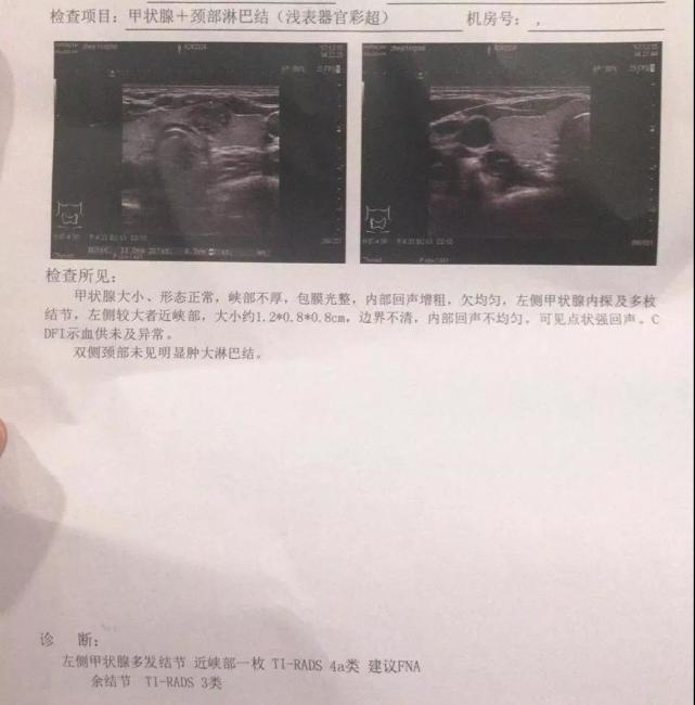 12月15日,医院的甲状腺b超报告出来了,医生说"很严重了!