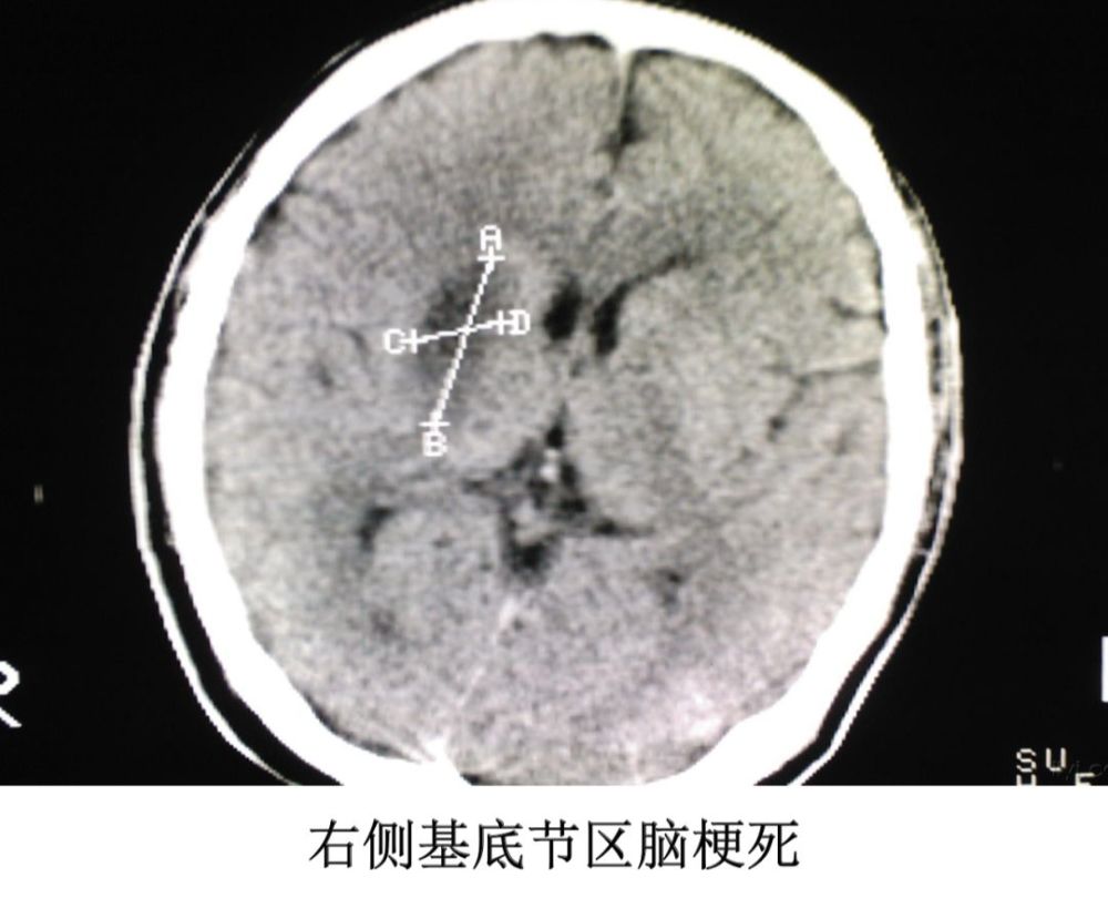 本篇內容至此結束,頭顱的影像學表現較為複雜,但對於複雜的事物,也