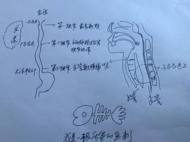 接下去我马上要进入食管这个地带玩耍啦~这里可不是随便可以闯入的哟