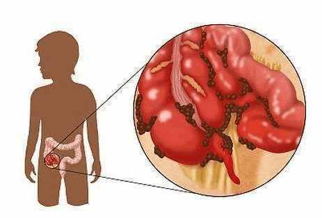 1个土方子便秘轻松治好, 可惜很多人都不知道