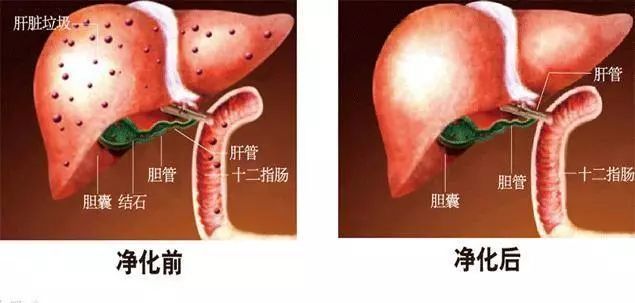 肝膽一通,疾病無蹤!