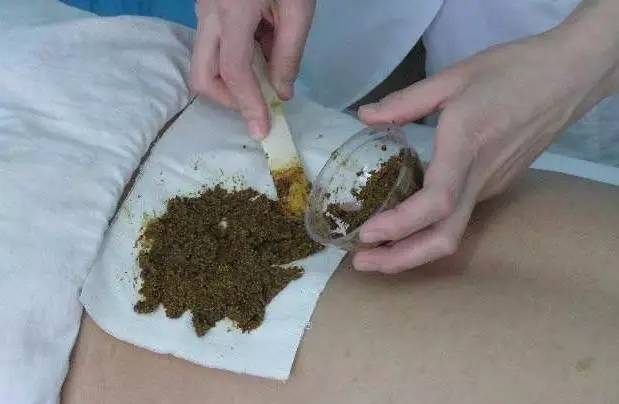 治疗带状疱疹5种外敷法