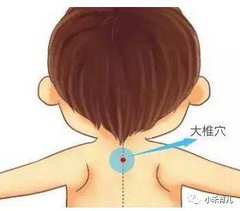 小儿积食发烧怎么办?