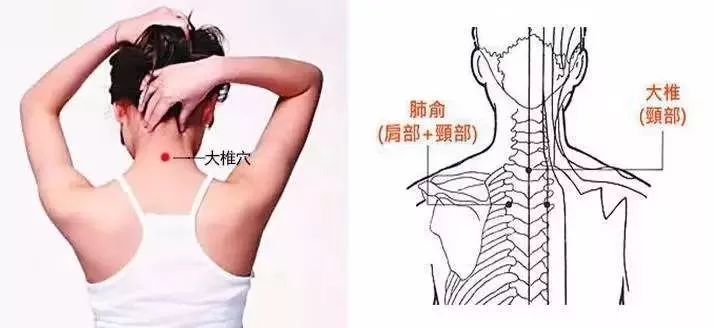 脖子穴位 腾讯网