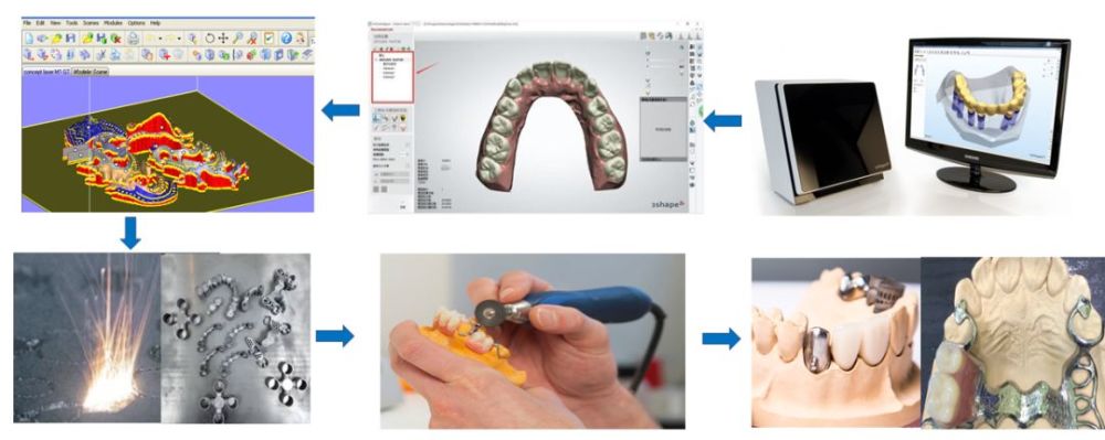 【独家专访】3D打印将义齿加工带入智能