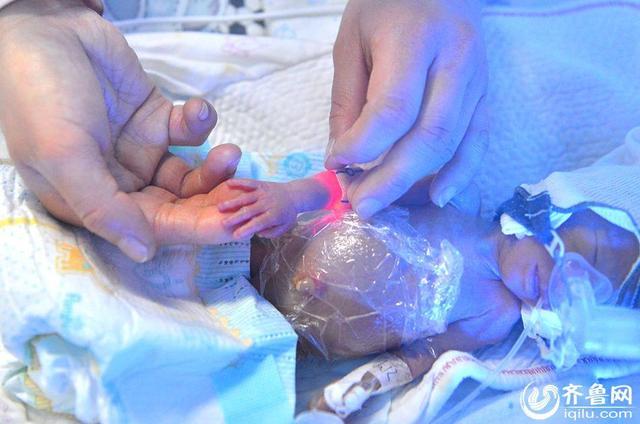 山东菏泽31岁妈妈生下五胞胎最小婴儿仅1斤重图