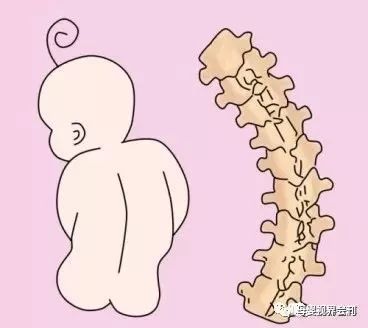 6个月宝宝脊椎变形凶手竟是它99妈妈都在用