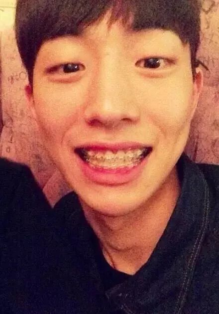 比如跟秀智一同出演新剧的南柱赫,就曾在ins上晒过自己的牙套图▼其实