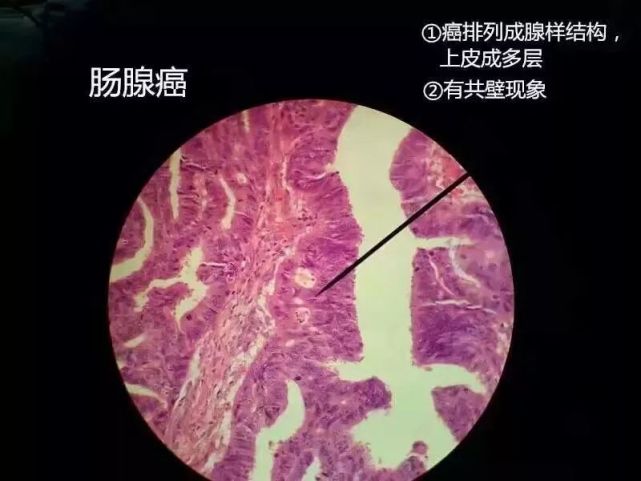 病理学切片库