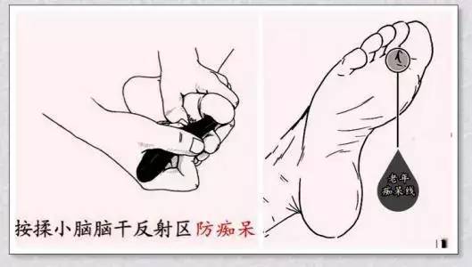 找到痴呆线预防老年痴呆