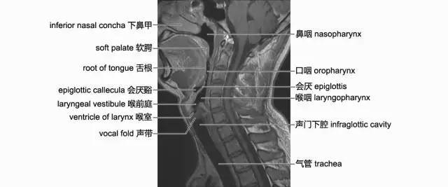 頸部影像解剖