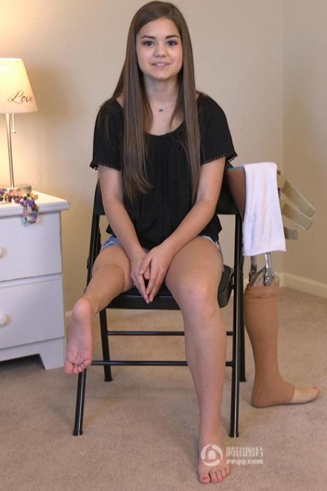 女孩因肿瘤截肢换上义肢继续跳芭蕾