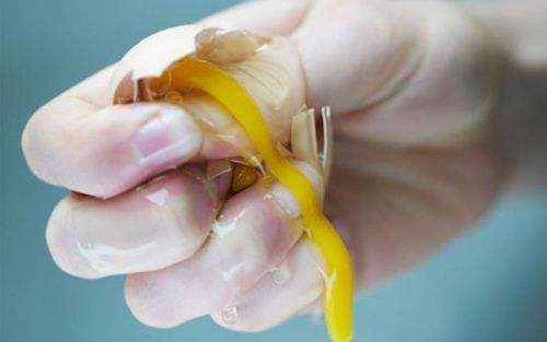 你的"小老弟"上莫名其妙出现了弯弯曲曲的东西可得注意了?