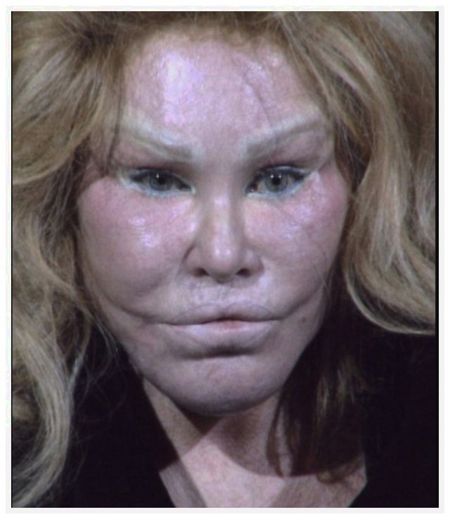 她因离婚获得20亿美元赔偿,迷恋上整容后,整个人都变了!