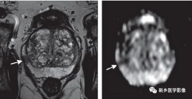 腾讯内容开放平台