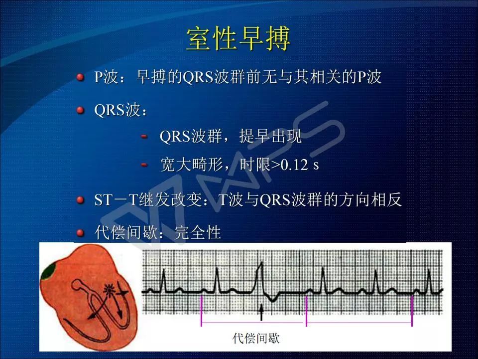 心電圖速度異常快慢堵亂ppt