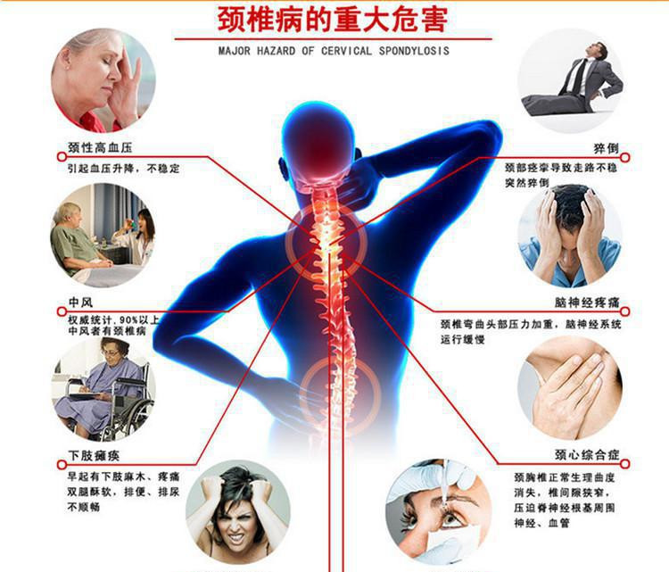 颈椎病会出现什么症状 应该怎么诊断与治疗 腾讯新闻