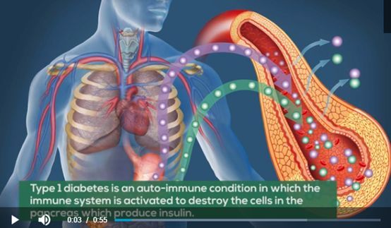 澳洲医学新突破:不打针,只喝水,治愈90%糖尿病