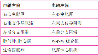 純乾貨圖文解析讀心電圖的9個步驟