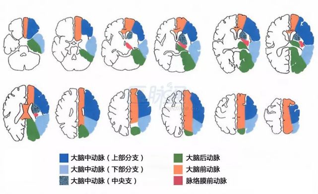 如下图所示,大脑前动脉(aca)为额叶内侧部分供血,大脑后动脉(pca)供应