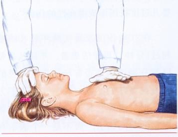 手掌重叠法(适用于较大儿童,图4)图2 双手环抱双拇指胸外心脏按压图1