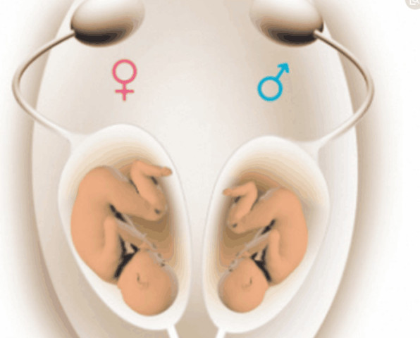 怀孕时如何判断胎儿性别?以下这几种征兆你有