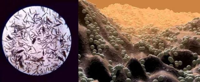 ▼ 高显微镜下看到皮肤上的螨虫 当你的脸突然发痒时或许就是它在蠕动