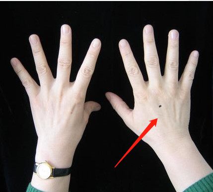 右手手背上有痣的男人运势如何?