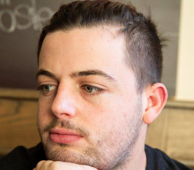 脸上长白毛有什么寓意呢?从健康和面相2个方