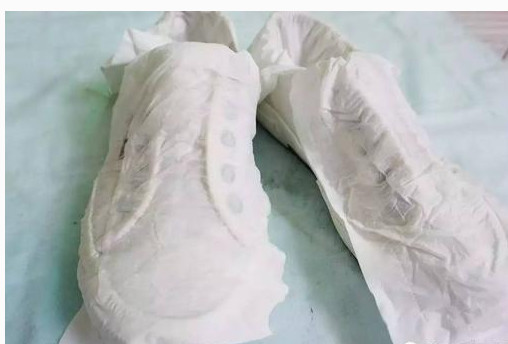 白鞋晒干了总会发黄怎么破?一分钟教你正确清洗小白鞋