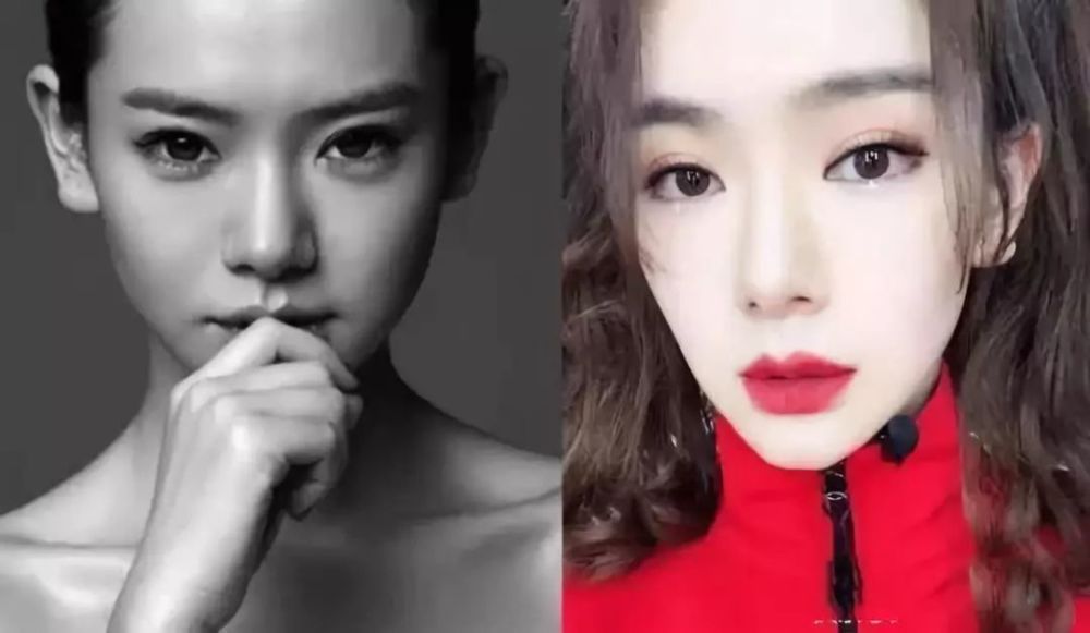 割过双眼皮的10位明星 戚薇美出新高度 薛之谦像换了一个人