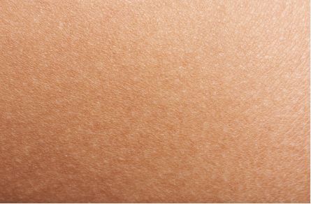 抗衰老两大法宝 除了抗氧化,另外一个是抗糖化