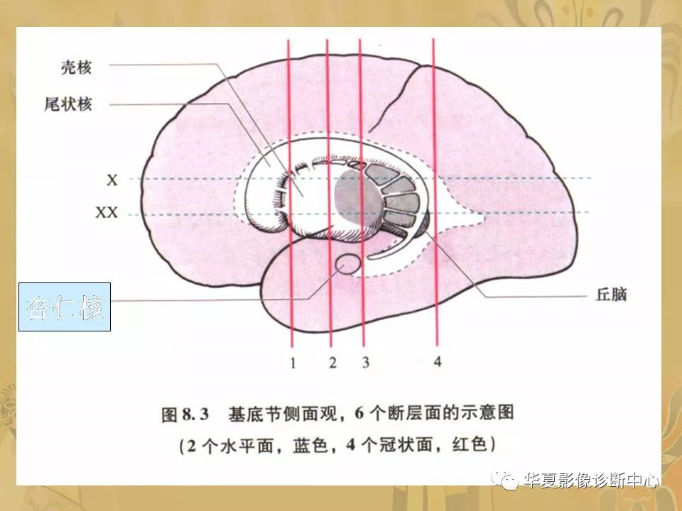 基底节区解剖位置关系图