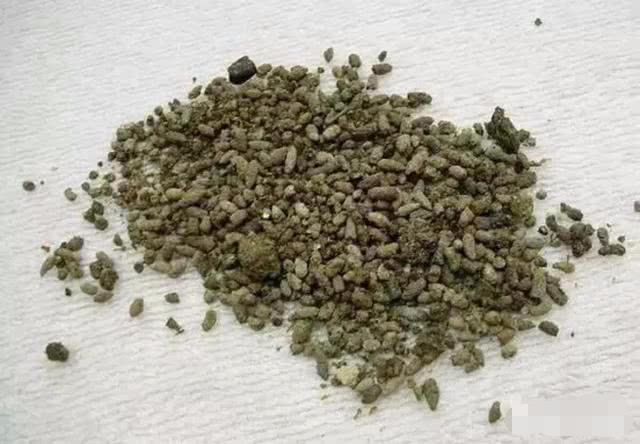 明朝的奇葩皇帝嘉靖就曾经为了长寿吃粪便